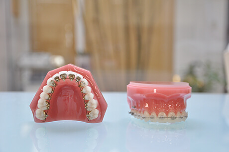 矯正歯科装置にはどんなものがありますか？